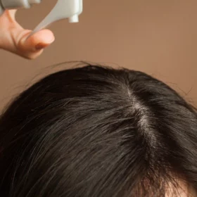 Pellicules : causes et solutions pour rétablir l’équilibre du cuir chevelu