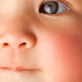 La peau de bébé